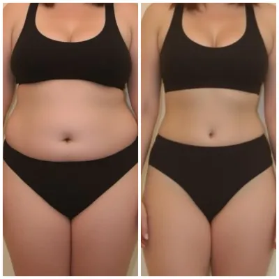 Laura - Antes y Después